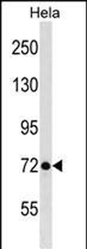 LAS1L Antibody (C-term)