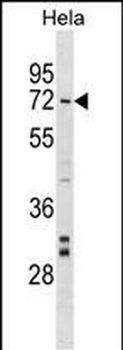 NARF Antibody (Center)