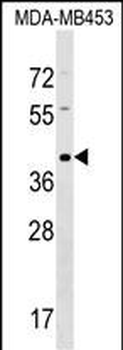 TAS2R9 Antibody (Center)