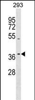TAS2R13 Antibody (C-term)