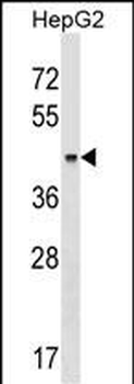 KRT23 Antibody (Center)