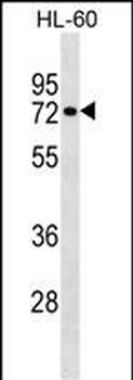 RHOT2 Antibody (Center)