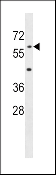 AOAH Antibody (Center)
