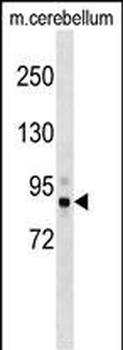 Mouse Tbk1 Antibody (N-term)
