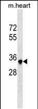 Mouse Sbk2 Antibody (C-term)