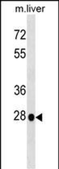 Mouse Hoxb5 Antibody (N-term)