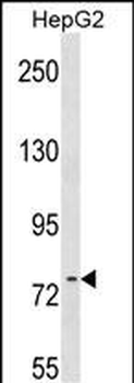RRN3 Antibody (Center)