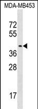 PSG9 Antibody (Center)