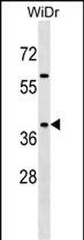 SYAP1 Antibody (C-term)