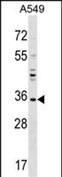 UNKL Antibody (N-term)