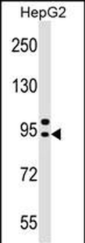AP4B1 Antibody (Center)