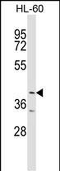 ABTB1 Antibody (C-term)