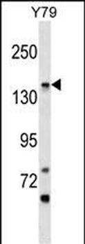 PIGO Antibody (C-term)