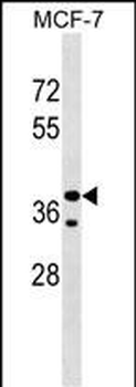 CCBE1 Antibody (Center)