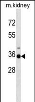 Mouse Hoxa3 Antibody (C-term)