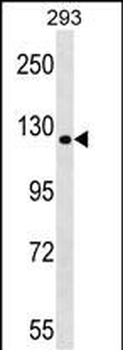 TBC1D1 Antibody (Center)