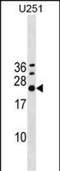 EXOSC4 Antibody (Center)
