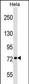KIF3B Antibody (N-term)