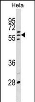 POLR3C Antibody (Center)