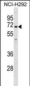 KCNN1 Antibody (C-term)
