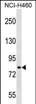 PJA2 Antibody (Center)