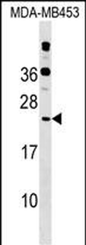 POLR2D Antibody (Center)