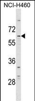 DCP1A Antibody (N-term)