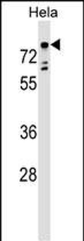 TBX2 Antibody (Center)