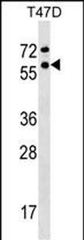 GTF2F1 Antibody (Center)