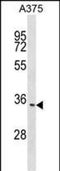 ITM2C Antibody (N-term)