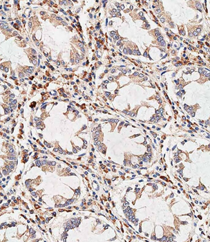 NOX1 Antibody (Center)