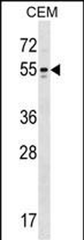 KCNA6 Antibody (N-term)
