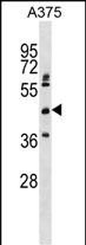 ASPHD2 Antibody (Center)