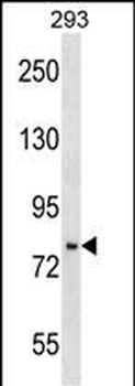 PHF16 Antibody (C-term)