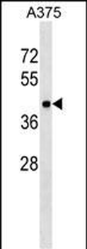 METAP1 Antibody (Center)