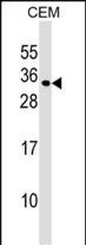 MXD1 Antibody (N-term)