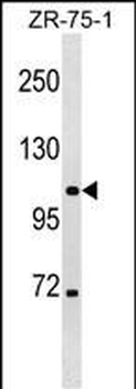 CLCN3 Antibody (Center)