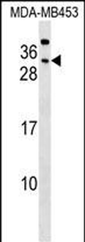 CEACAM7 Antibody (Center)