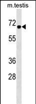CBX2 Antibody (Center)
