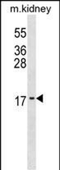 ID3 Antibody (N-term)