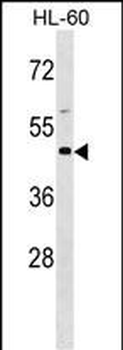 BSG Antibody (Center)