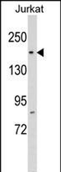 RPAP1 Antibody (N-term)