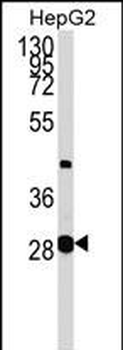 GLYCTK Antibody (N-term)