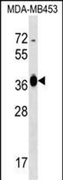 GFOD2 Antibody (N-term)