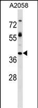 TPBG Antibody (Center)