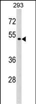 P2RX6 Antibody (Center)