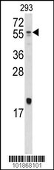 Bmp10 Antibody (N-term)