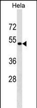 KRR1 Antibody (N-term)