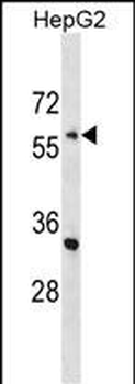 ENC1 Antibody (C-term)