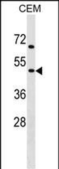 CHRNG Antibody (N-term)